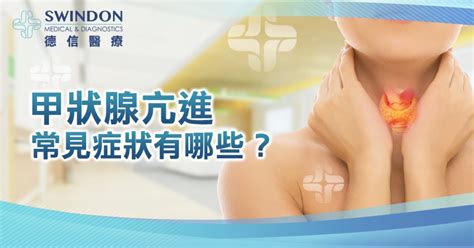 甲狀腺亢進常見症狀有哪些？ 德信醫療