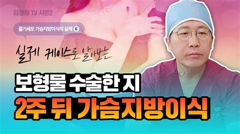 ⭐줄기세포 가슴지방이식 실제6⭐보형물 수술한 지 2주 뒤 가슴지방이식 가슴지방이식 줄기세포가슴성형 줄기세포가슴이식