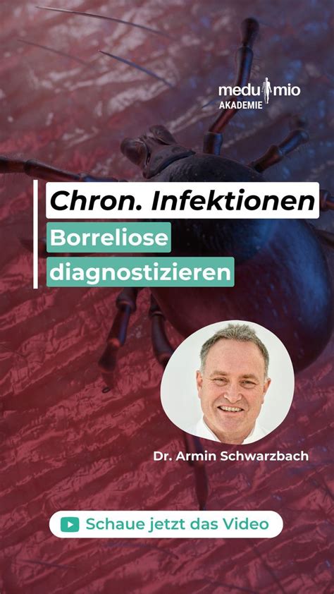 Jährlich kommt es schätzungsweise zu über einer Million Borreliose Neu