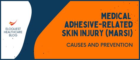 Medical Adhesive Related Skin Injury MARSI Causes And Prevention