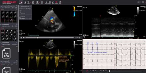 Dicom Viewing Software Diagnostic For Pacs Universal Meddream Web Dicom Softneta