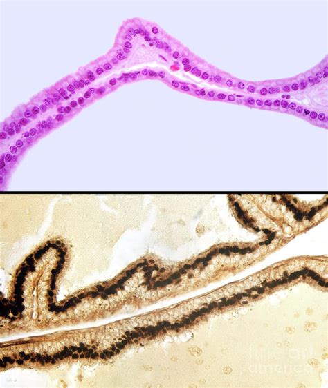 Simple Columnar Epithelium Photograph By Jose Calvo Science Photo