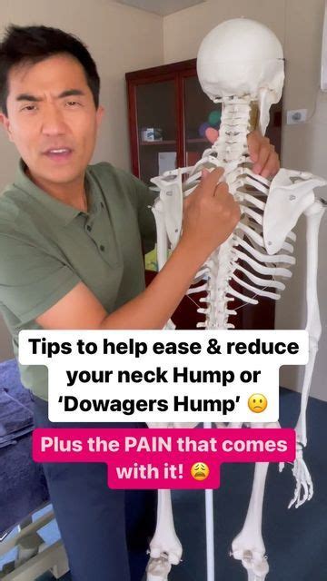 A Man Holding Up A Fake Skeleton In Front Of His Face And The Caption