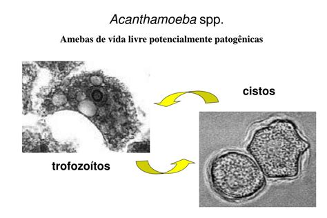 Ppt Amebíase Entamoeba Histolytica Powerpoint Presentation Free Download Id5487412