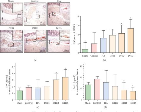 Figure 1 From Danhong Injection Alleviates Postoperative Intra