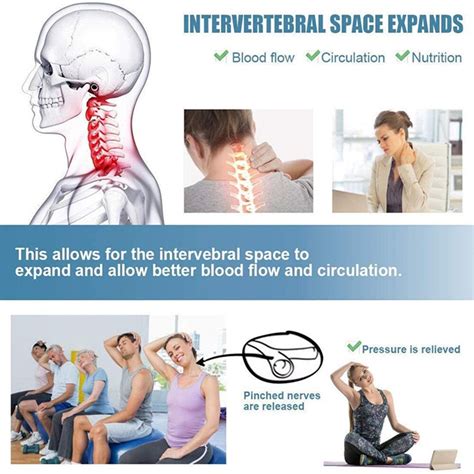 Cervical Radiculopathy Exercises