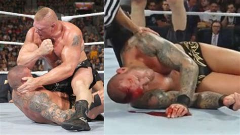 Brock Lesnar Verletzt Unabsichtlich Randy Orton Beim Summerslam Video