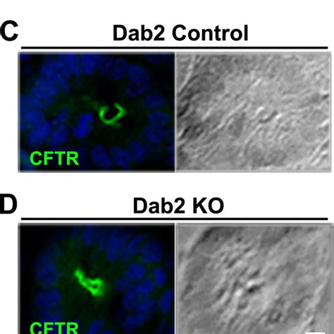 Distribution Of CFTR Relative To AP 2 Myosin VI And Dab2 In The