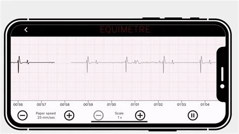 Horse Heart Rate Monitor For Veterinarians Equimetre Vet Arioneo