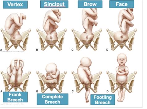 Maternity Physiology Assessment Of Labor And Birth Flashcards