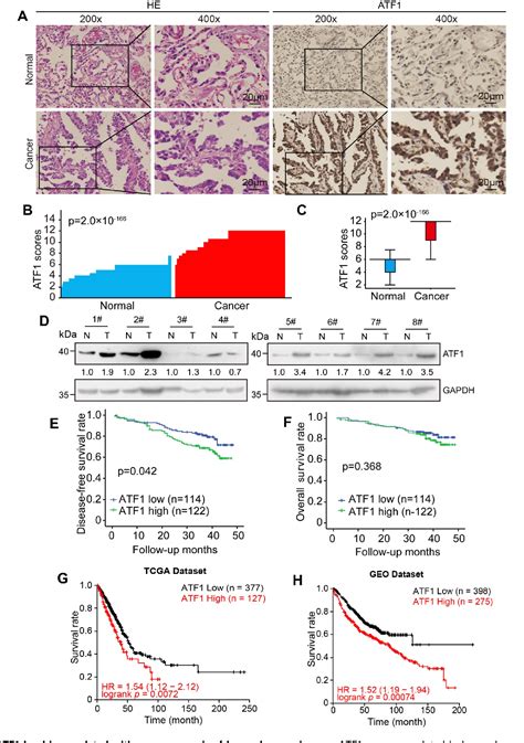 Table 1 From Atf1 Promotes The Malignancy Of Lung Adenocarcinoma Cells