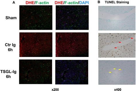 A Soluble Form Of P Selectin Glycoprotein Ligand Requires Signaling