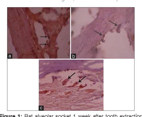 Figure 1 From Evaluation Of The Effects Of Two Different Bone Resorption Inhibitors On