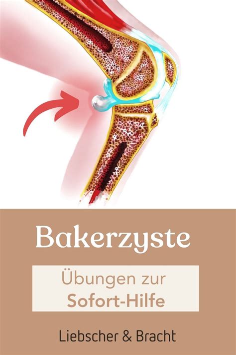 Bakerzyste Bungen Zur Selbsthilfe Bei Schmerzen Artofit