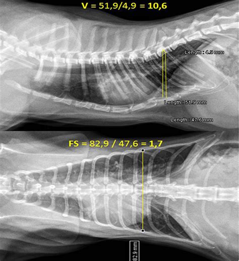 42 HQ Images Pectus Excavatum Cat Treatment Workshop Internacional En