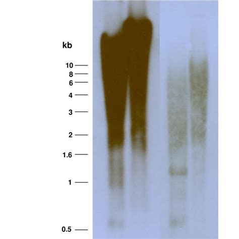 Southern Hybridization Analysis Of Genomic Dna Of S Mansoni Probed