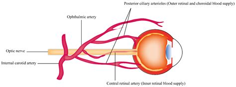 Central Retinal Artery Occlusion Anatomy