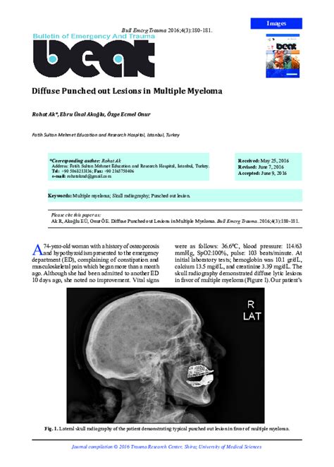 Pdf Diffuse Punched Out Lesions In Multiple Myeloma Ebru Akoglu