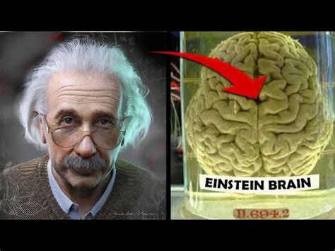 How Einstein S Brain Was Different Youtube