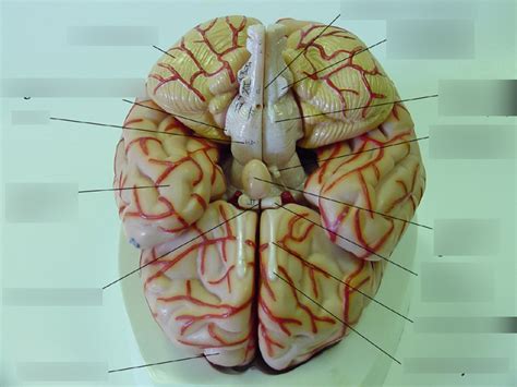 Brain Model Inferior Diagram Quizlet