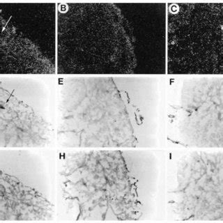 Myod Precedes The Expression Of Myogenin In The Caudal Somites Of Myf