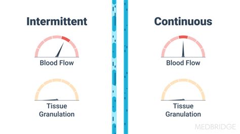 Wound Debridement, Dressing Types, and Coverage Selection | MedBridge