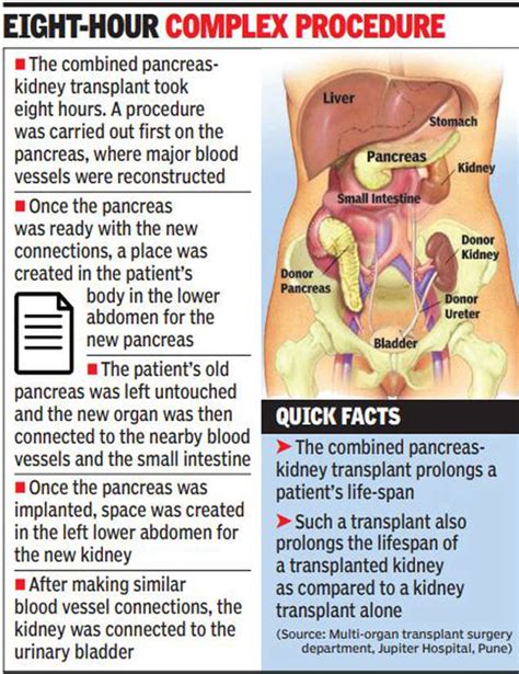 Pune: Pancreas-kidney transplant reverses businessman’s diabetes | Pune ...