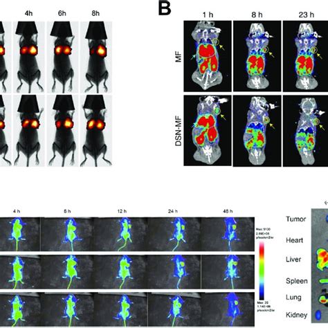 In Vivo Bio Distribution Of Different Macrophage Mediated Drug Delivery