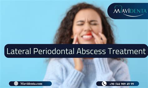 Lateral Periodontal Abscess Treatment: Symptoms, Causes 2024