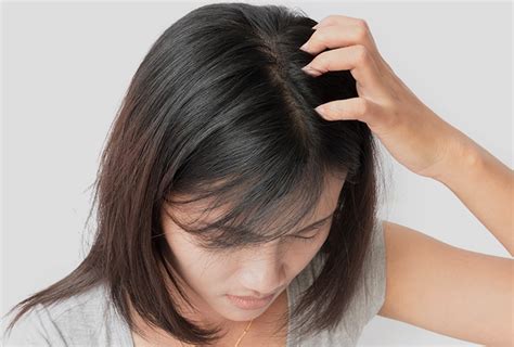 How to Treat Scalp Scabs | Top 10 Home Remedies