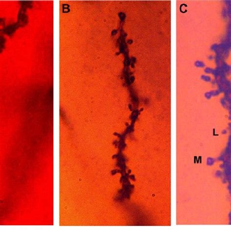 The extent and distribution of neuronal dendritic branching in the ...