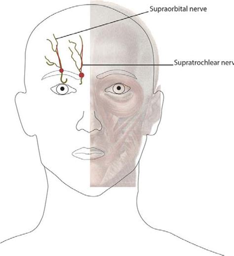 Supraorbital Nerve V1