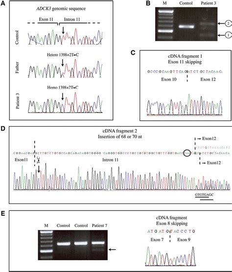 Ubiquinone Biosynthesis Pathway Semantic Scholar