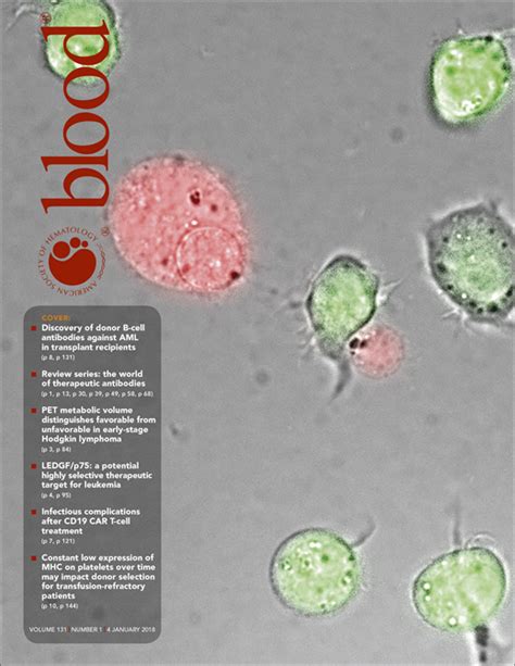 Cabot rings and marked anisopoikilocytosis in Imerslund-Gräsbeck syndrome | Blood | American ...