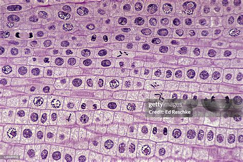 Phases Of Mitosis Onion Root Tip