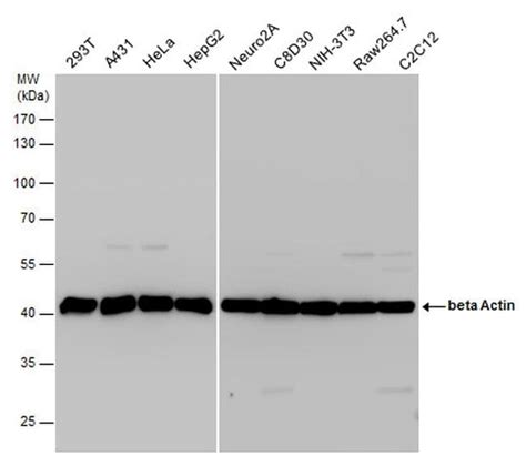 beta Actin Antibody (PA5-85291)