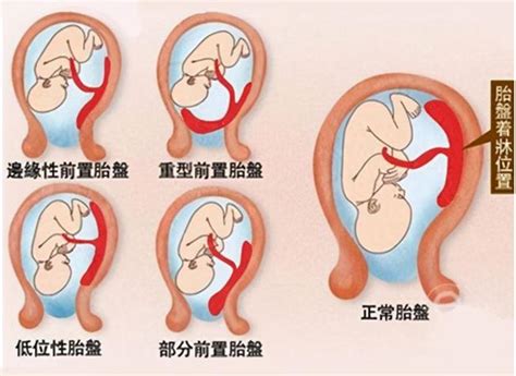 怀孕后如果是这三种体型说明胎儿状况良好孕妈不用担心