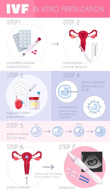 Infografía De Fecundación In Vitro Plana Coloreada Fiv Con Pasos Para El Progreso Del Embarazo