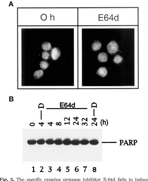 Figure From Proteasome Inhibition Leads To Significant Reduction Of