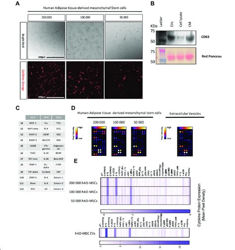 Human Adipose Tissue Derived Stem Cells And Extracellular Vesicles