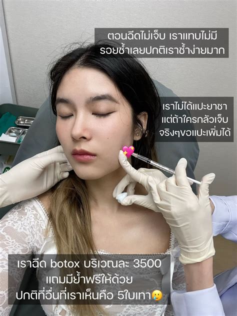 รีวิวฉีดโบกราม คลินิกสีฟ้า ในงบประหยัด💸ที่สุด ️ แกลเลอรีที่โพสต์โดย