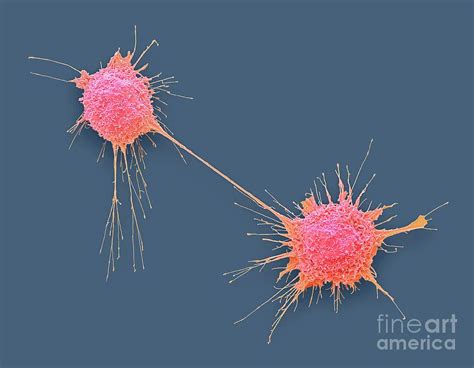 Dividing Prostate Cancer Cell By Steve Gschmeissner Science Photo Library