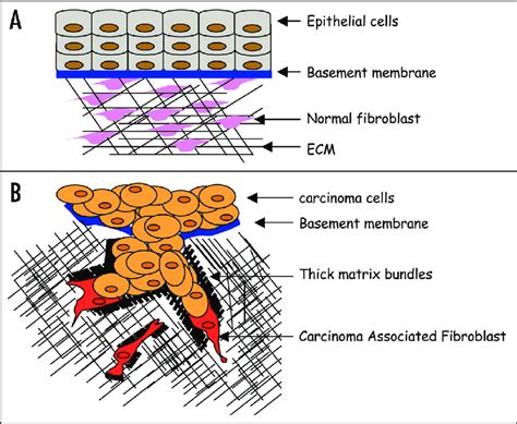 Model Of Carcinoma Cells Collective Invasion A Schematic