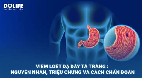 Viêm loét dạ dày tá tràng Nguyên nhân triệu chứng và cách chẩn đoán