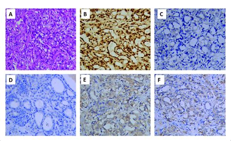 Hematoxylin And Eosin He Staining And Immunohistochemical Staining