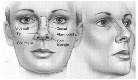 The Nasal Dorsum Management Of The Upper Two Thirds Of The Nose Ento