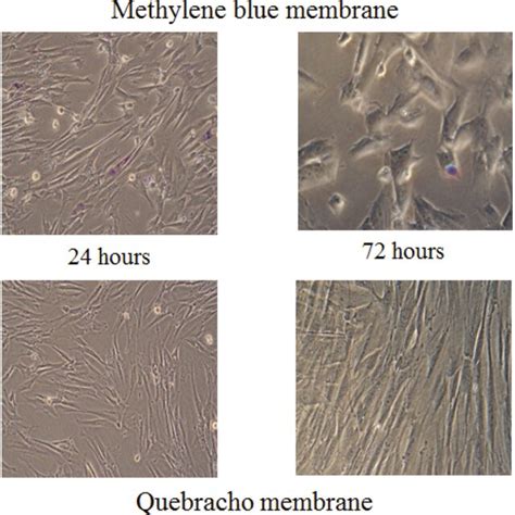 5 Microscopic Analysis Of Human Dermal Fibroblast Culture Samples Sowed