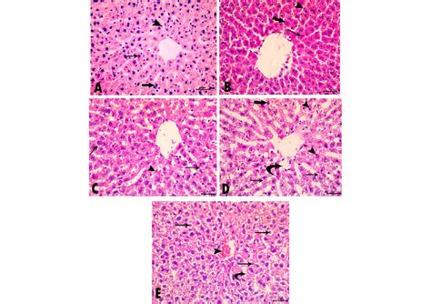 Photomicrographs Of Sections In The Liver Stained With Hande ×400 A Download Scientific