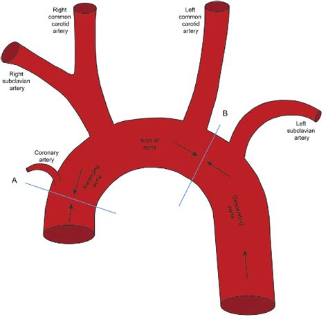 Table 1 From Extracorporeal Membrane Oxygenation Ecmo During