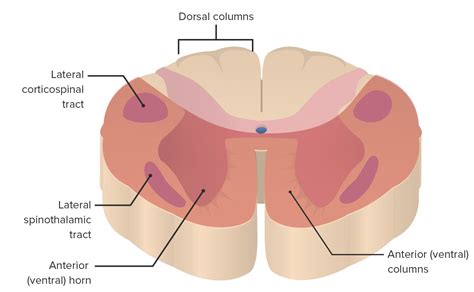 Posterior Cord Syndrome What Is It Causes Signs And 53 OFF